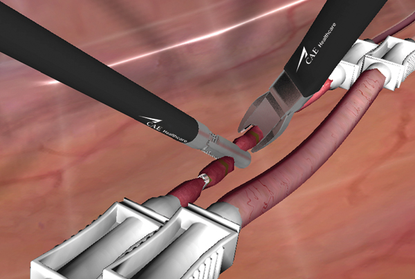 Clip application