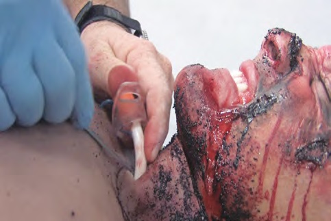 surgicalcutsuit