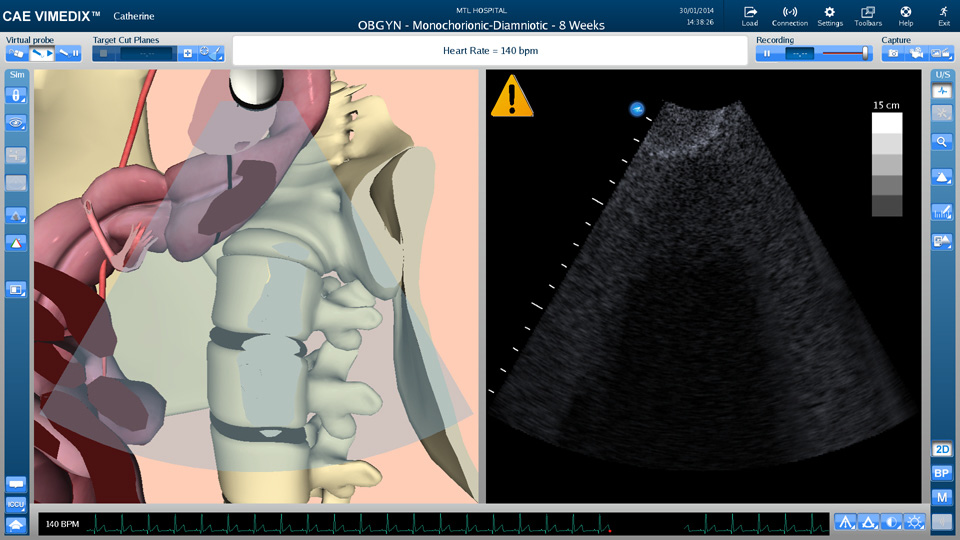 vimedixcardio
