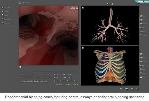 Simbionix ENDO Mentor Suite Bronchomenter