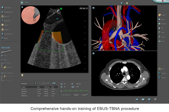 Simbionix ENDO Mentor Suite Bronchomenter