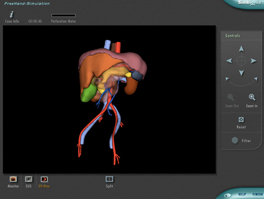 Simbionix ENDO Mentor Suite