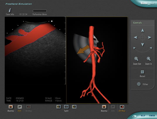 Simbionix ENDO Mentor Suite